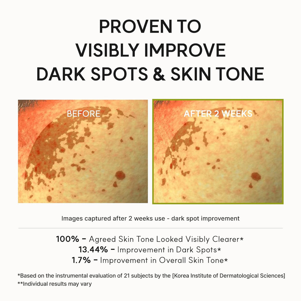 Before and after two weeks of use: dark spots and hyperpigmentation visibly reduced, a 13.44% improvement measured on 21 subjects